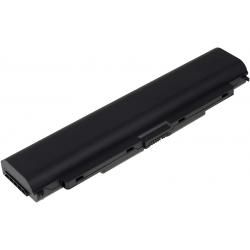 baterie pro Lenovo ThinkPad L440 5200mAh